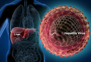 Hepatitis 1